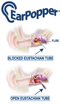 Eustachian tube